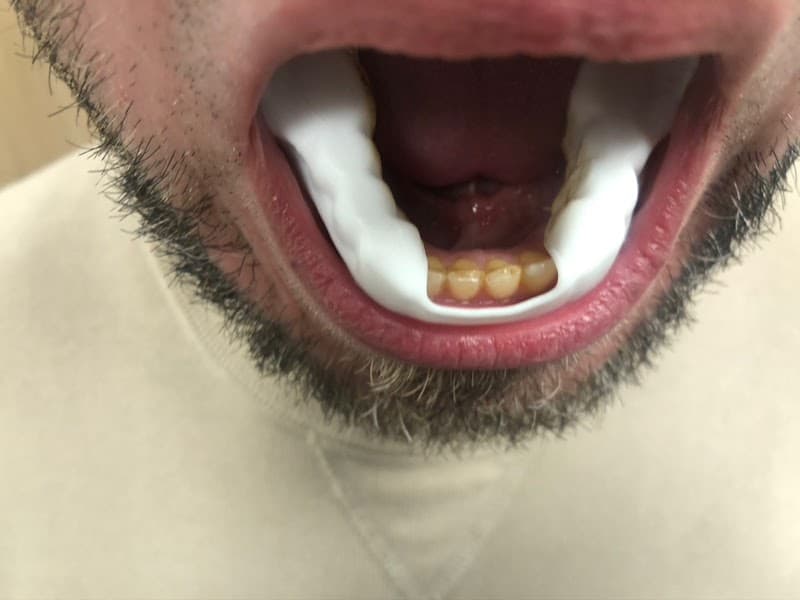 Photo de Docteur Bruno LELLOUCHE. Clinique du Mont-Louis. Chirurgie ORL.. Sommeil